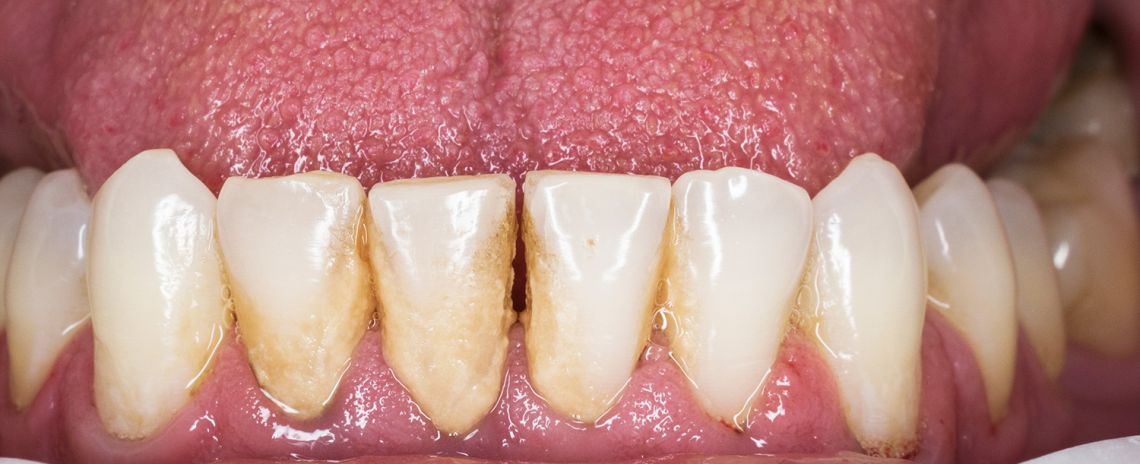 Hygiene Clean Before