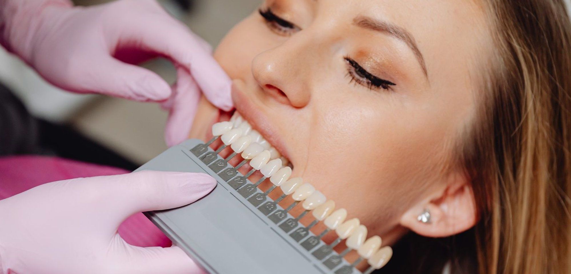 Teeth Whitening Offer in East Horsley: £299 | November 9th-30th 2026