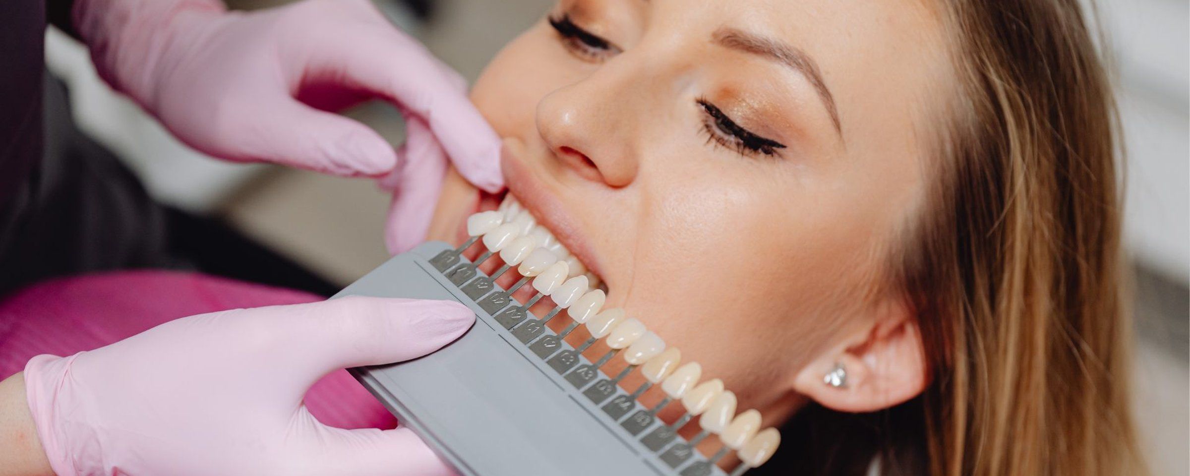 Teeth Whitening Offer in East Horsley: £299 | November 9th-30th 2026